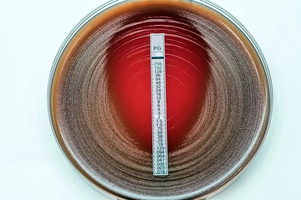 Fig. 3: Penicillin Etest for Staphylococcus aureus.