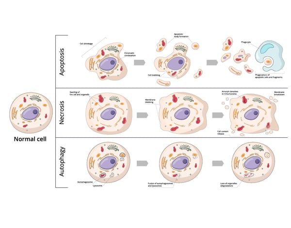 Fig. 1: Three forms of cell death: Apoptosis, autophagy and necrosis.