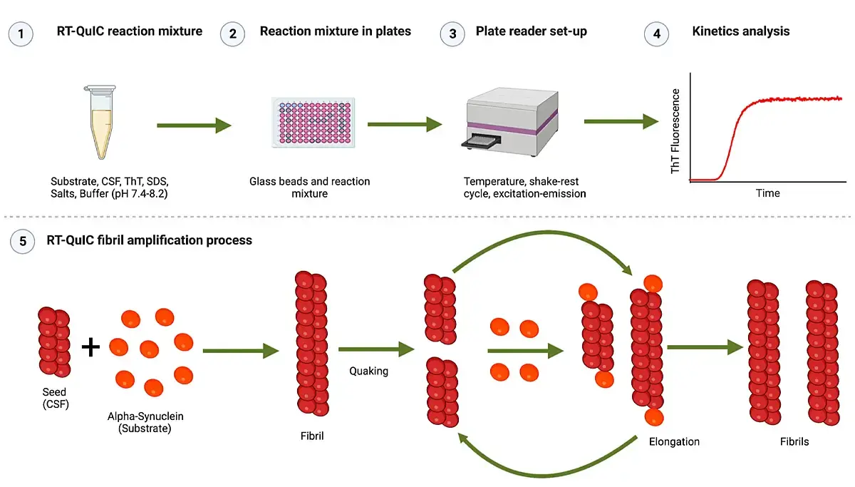 Fig. 4: Schematic representation of an RT-QuIC assay. (1) Reaction mixture set up; (2) Microplate set up; (3) Microplate reader set up; (4) Kinetic analysis; (5) Fibril amplification process for RT-QuIC. Creative Commons 4.0 license Figure 1A unmodified in Peña-Bautista C, Kumar R, Baquero M, Johansson J, Cháfer-Pericás C, Abelein A, Ferreira D. Misfolded alpha-synuclein detection by RT-QuIC in dementia with lewy bodies: a systematic review and meta-analysis. Front Mol Biosci. 2023 May 17;10:1193458. doi: 10.3389/fmolb.2023.1193458.