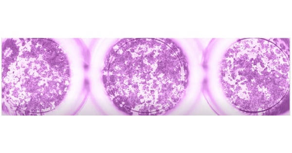 Fig. 1: Adherent cells in a microplate represent a heterogeneous sample.