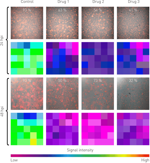 Fig. 2: Comparison of images and well-scans showing viral replication in infected cells either non-treated or treated with different drugs.