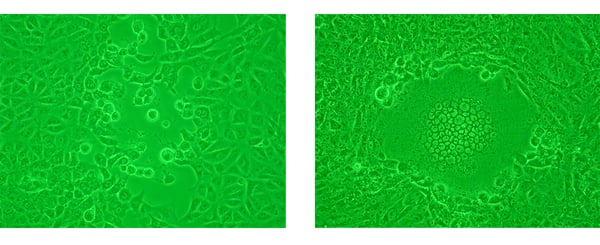Fig. 4: Examples of cytopathic effect (CPE): cell rounding (left) and syncytium formation (right) induced on Vero cells by a mutant strain of herpes simplex virus. Phase-contrast microscopy under green light. Source: Y tambe, Wikimedia Commons.