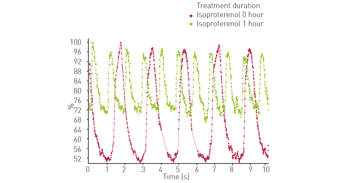 Fig. 3: Calcium flux after isoproterenol treatment. At the indicated timepoints after treatment of the iPSC cardiomyocytes with isoproterenol, fluorescence detection of Rhod-4 was performed (0 h = 30 BPM, 1 h = 66 BPM).