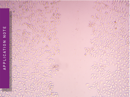 Analysis of migration using the OrisTM Cell Migration Assay-TriCoated kit