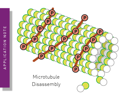 Comparing site specific phospho-tau in normal and Alzheimer's disease brains