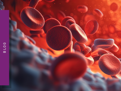 atherosclerotic-vascular-disease-teaser