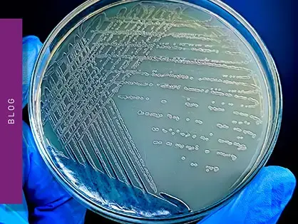 The BET test or bacterial endotoxin test