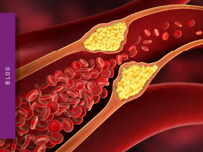 Ischemia Reperfusion Research
