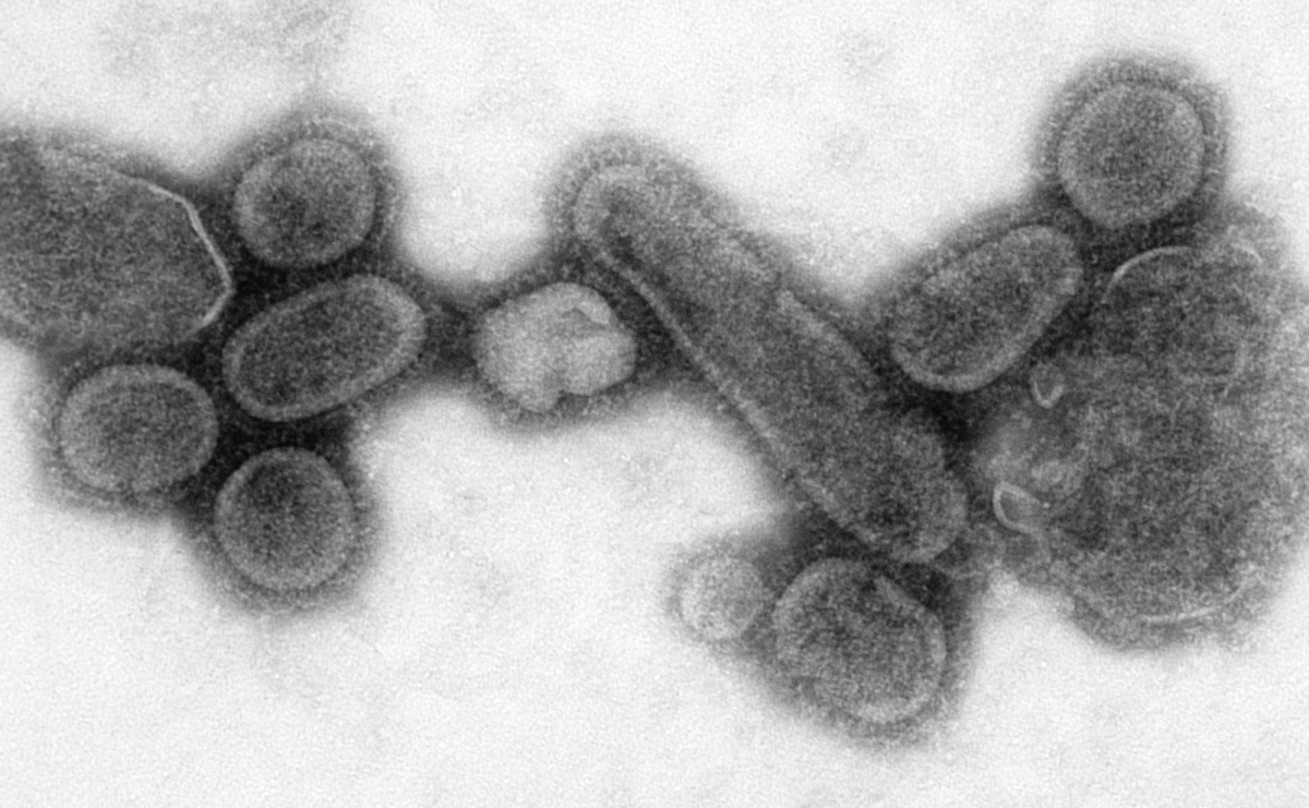 Fig. 3: an electron microscopic image of the influenza A virus subtype H1N1. Source: Centers for Disease Control and Prevention's Public Health Image Library.